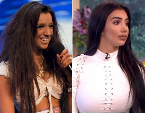 chloe khan before surgery|chloe khan plastic surgery.